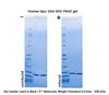 Recombinant Human Apo-SAA SDS-PAGE gel