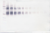 Biotinylated Anti-Human sIL-4 Receptor α Western Blot Unreduced