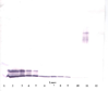 Biotinylated Anti-Human PF-4 (CXCL4) Western Blot Reduced