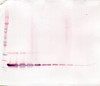 Biotinylated Anti-Human sTNF Receptor Type II Western Blot Unreduced