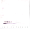Biotinylated Anti-Human RANTES (CCL5) Western Blot Reduced